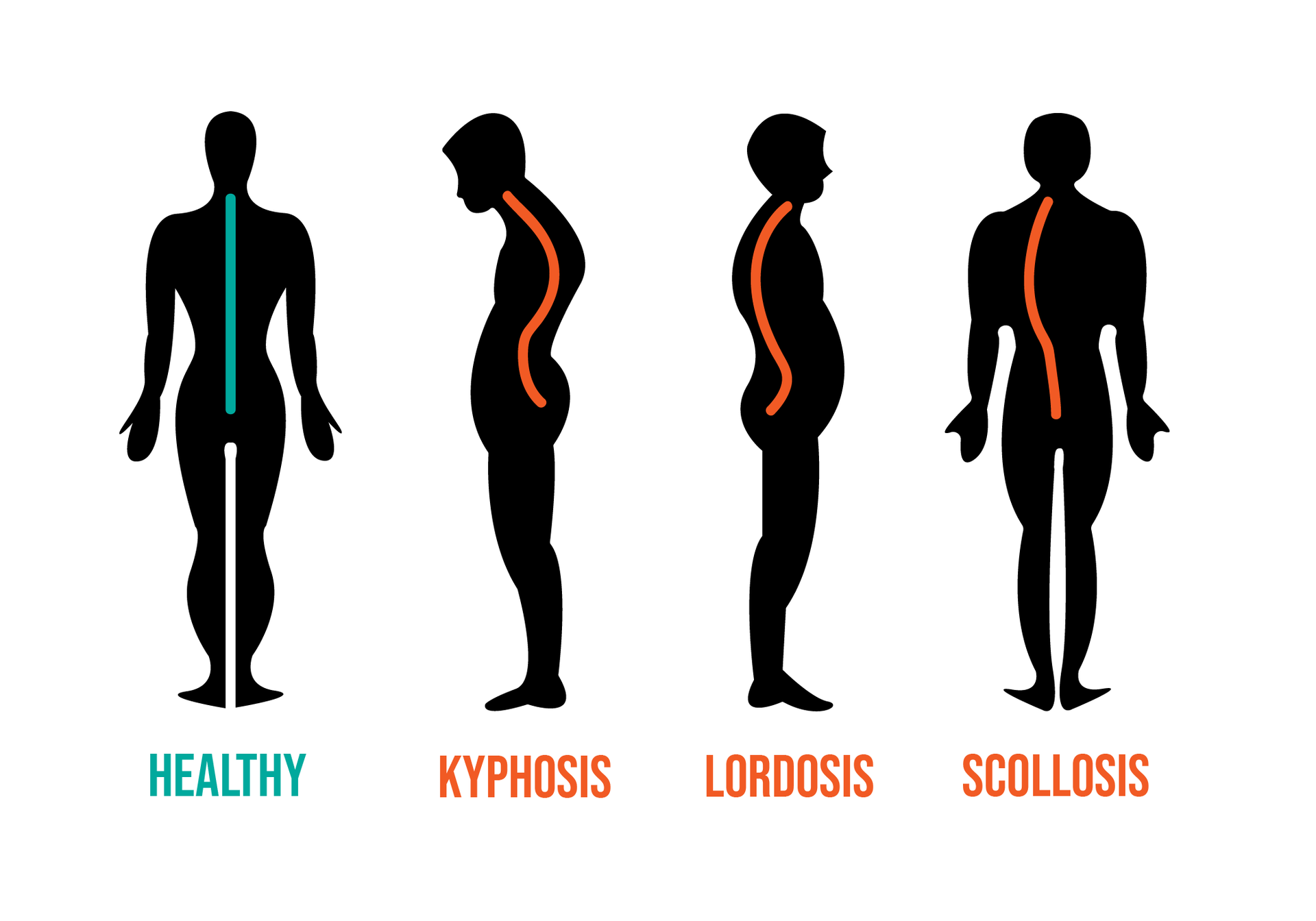 Disney pictures posture in people. Normal posture. Lordosis and Kyphosis. Posture Test. Lordosis Behavior.